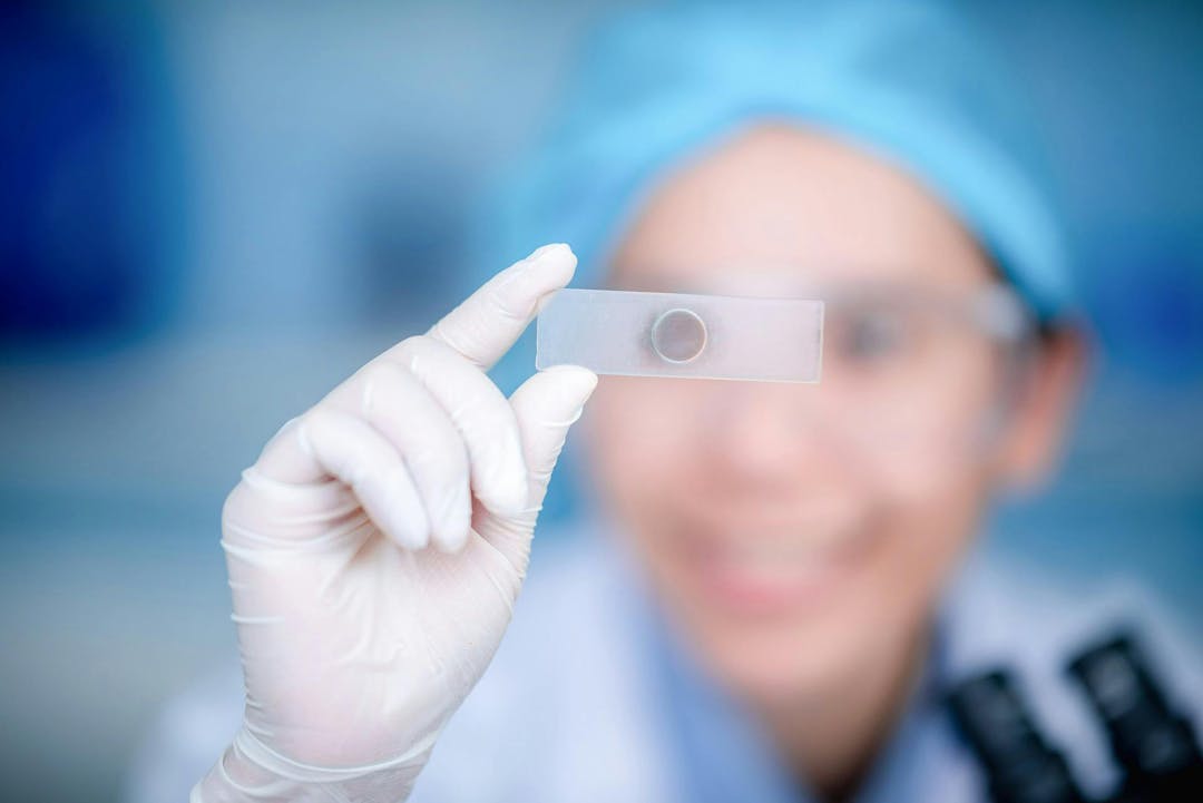 A gloved hand holds up a microscope slide with a circular specimen, in a laboratory environment with blurred figure wearing safety glasses and a medical cap in the background.