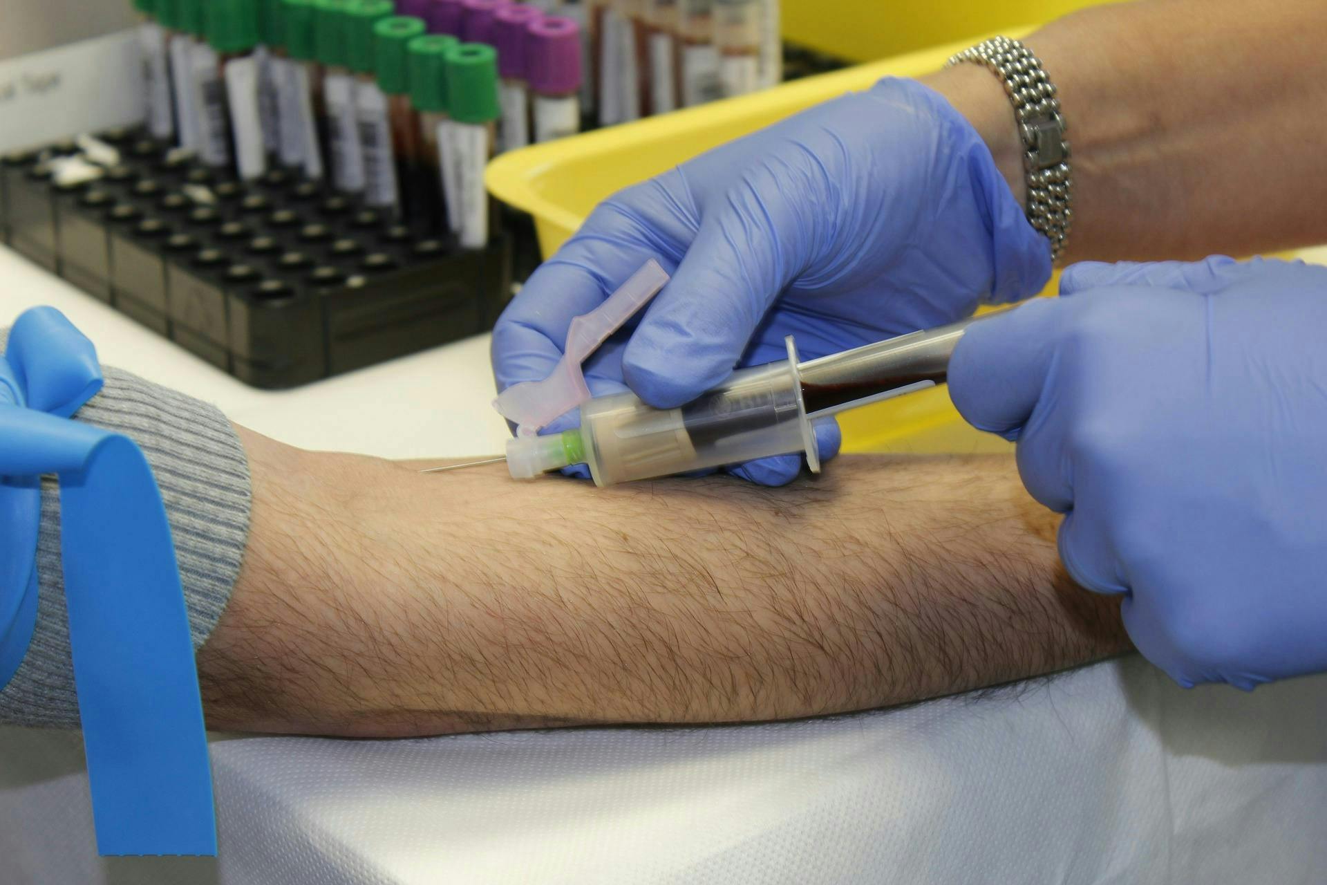 A medical professional, wearing blue gloves, draws blood from a patient’s arm using a syringe; background includes test tubes in a rack.